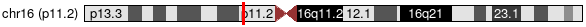 Cytoband Image
