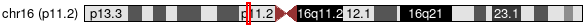 Cytoband Image