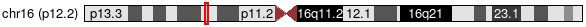 Cytoband Image